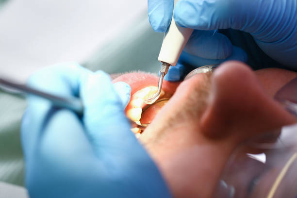 Best Pediatric Emergency Dentist in Genoa, IL