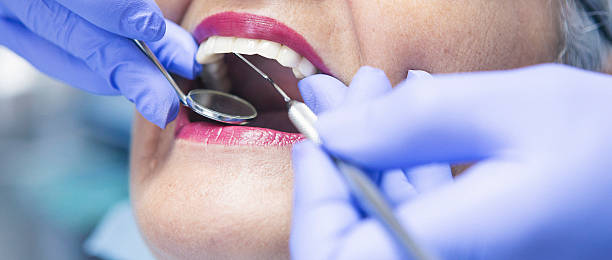 Best Emergency Dentist for Lost Fillings or Crowns in Genoa, IL