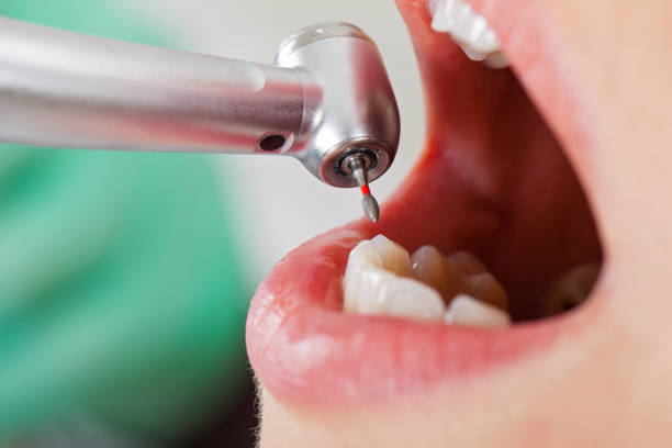 Best Emergency Dentist for Knocked-Out Tooth in Genoa, IL